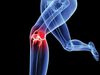 Med Tent: What You Kneed To Know About Patellar Tendinitis: Photo: iStockphoto.comHow to prevent and treat pat...